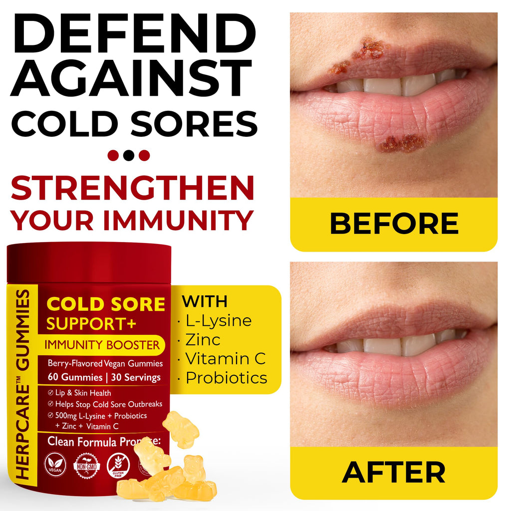 Cold Sore Treatment with L-Lysine, Zinc & Vitamin C W7702