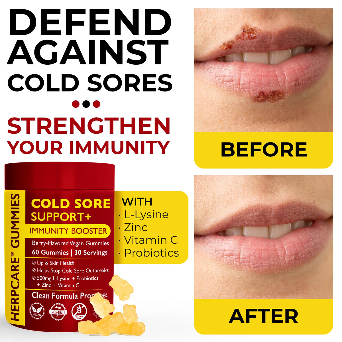 Cold Sore Treatment with L-Lysine, Zinc & Vitamin C W7702